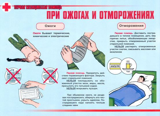 Как помочь при ожоге в домашних условиях